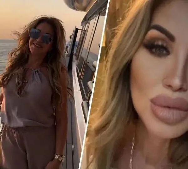 Carmen Geiss zeigt neues Gesicht nach Beauty-OP &ndash; Fans geschockt und neugierig zugleich