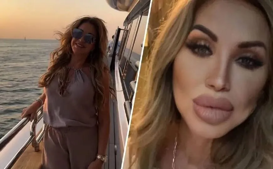 Carmen Geiss zeigt neues Gesicht nach Beauty-OP – Fans geschockt und neugierig zugleich