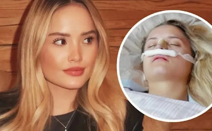 Davina Geiss und der Weg zur Selbstoptimierung: Von Botox zur Nasen-OP