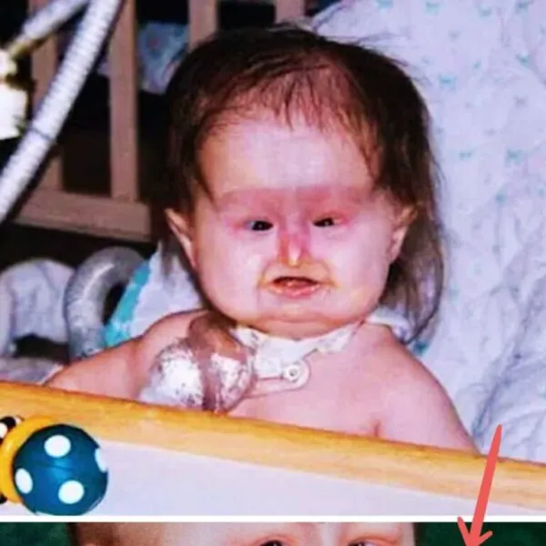 Baby Michelle bringt den Kreißsaal zum Schweigen – 25 Jahre später sieht sie fantastisch aus!
