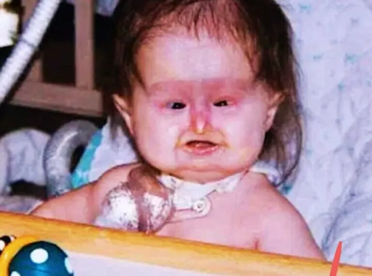 Baby Michelle bringt den Kreißsaal zum Schweigen – 25 Jahre später sieht sie fantastisch aus!