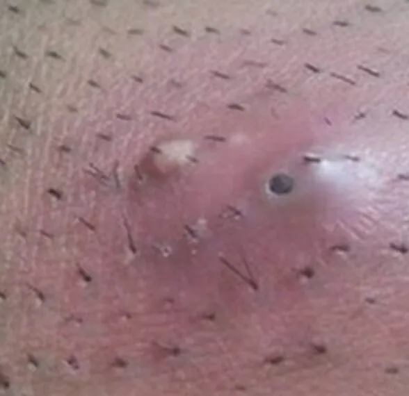 Darum solltest du dir „da unten“ vielleicht besser nicht die Haare rasieren