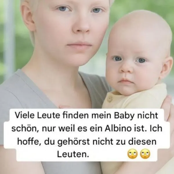 &bdquo;Sie lachten &uuml;ber mein Baby &ndash; bis sie die Wahrheit in seinen Augen erkannten&ldquo;