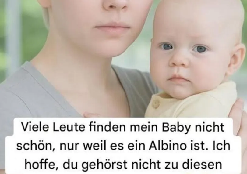 &bdquo;Sie lachten &uuml;ber mein Baby &ndash; bis sie die Wahrheit in seinen Augen erkannten&ldquo;