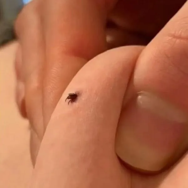 Zecken im Haus gefunden &ndash; was bedeutet das und wie sollte man richtig reagieren?