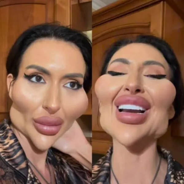 Wenn Sch&ouml;nheitsideale, &Ouml;ffentlichkeit und Familie aufeinandertreffen