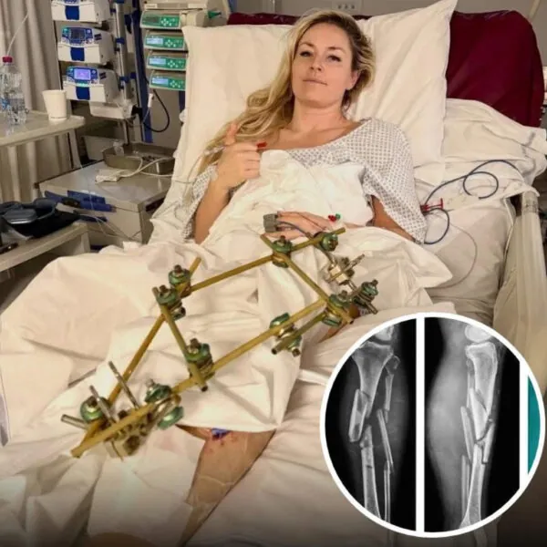 Lindsey Vonn nach schwerem Sturz: Zwischen Schock, Hoffnung und ungewisser Zukunft