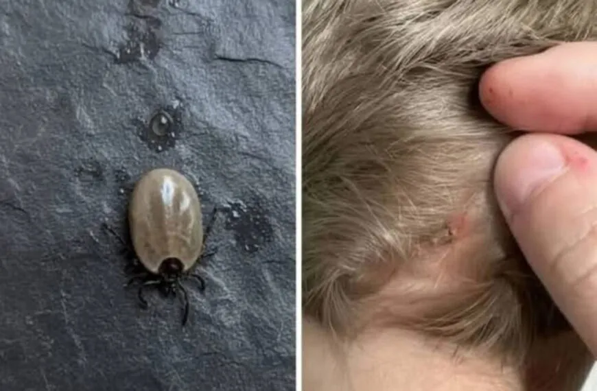 Wenn ein Zeckenkontakt zur Sorge wird: Was Eltern wirklich wissen sollten